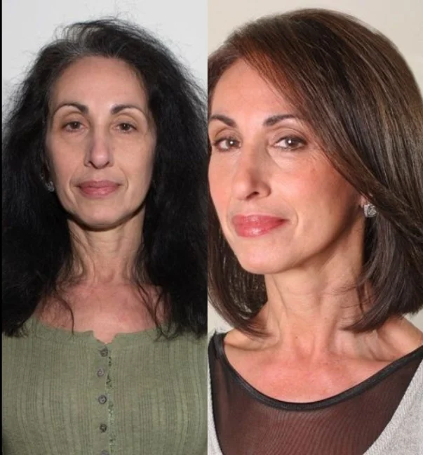 CORTE ANTES E DEPOIS 3 - M